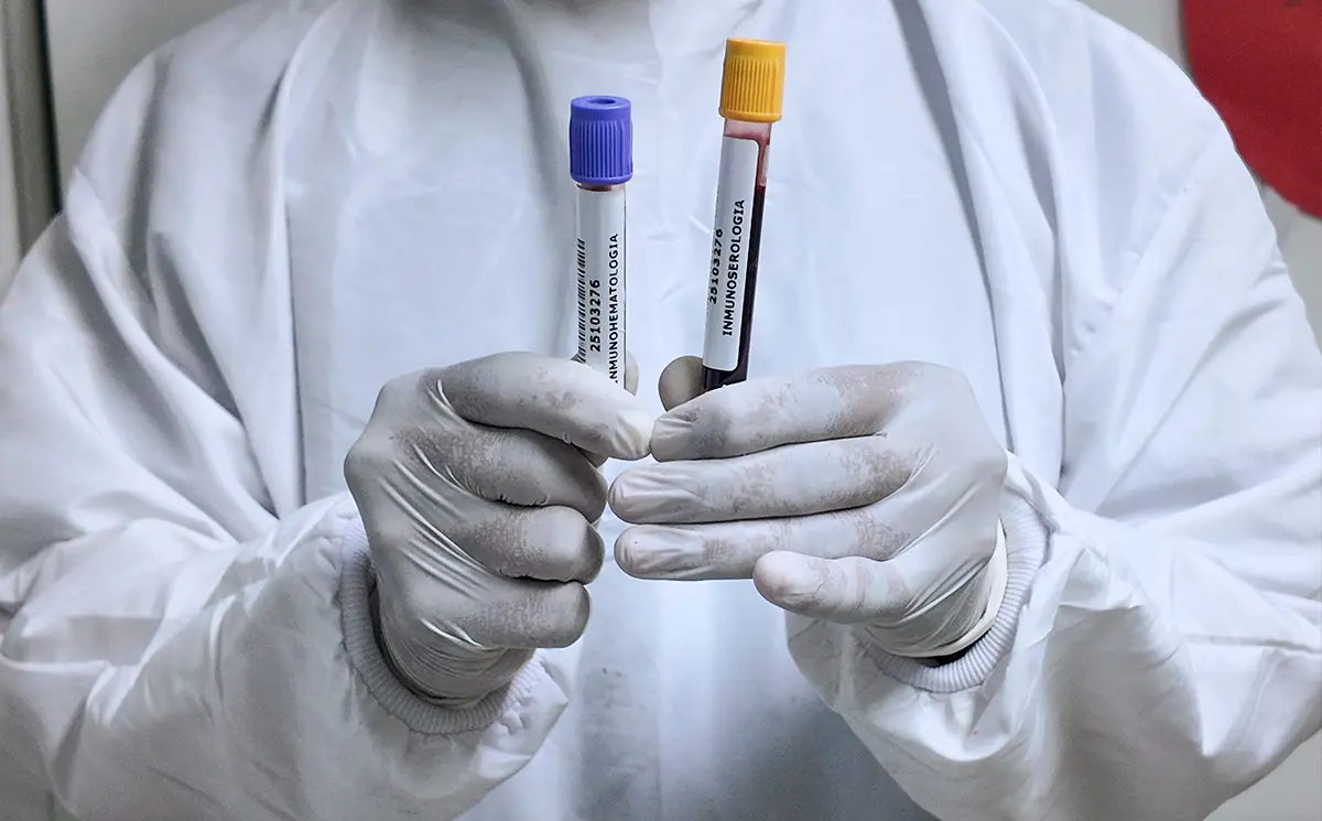 Procesamiento de Pruebas Infecciosas