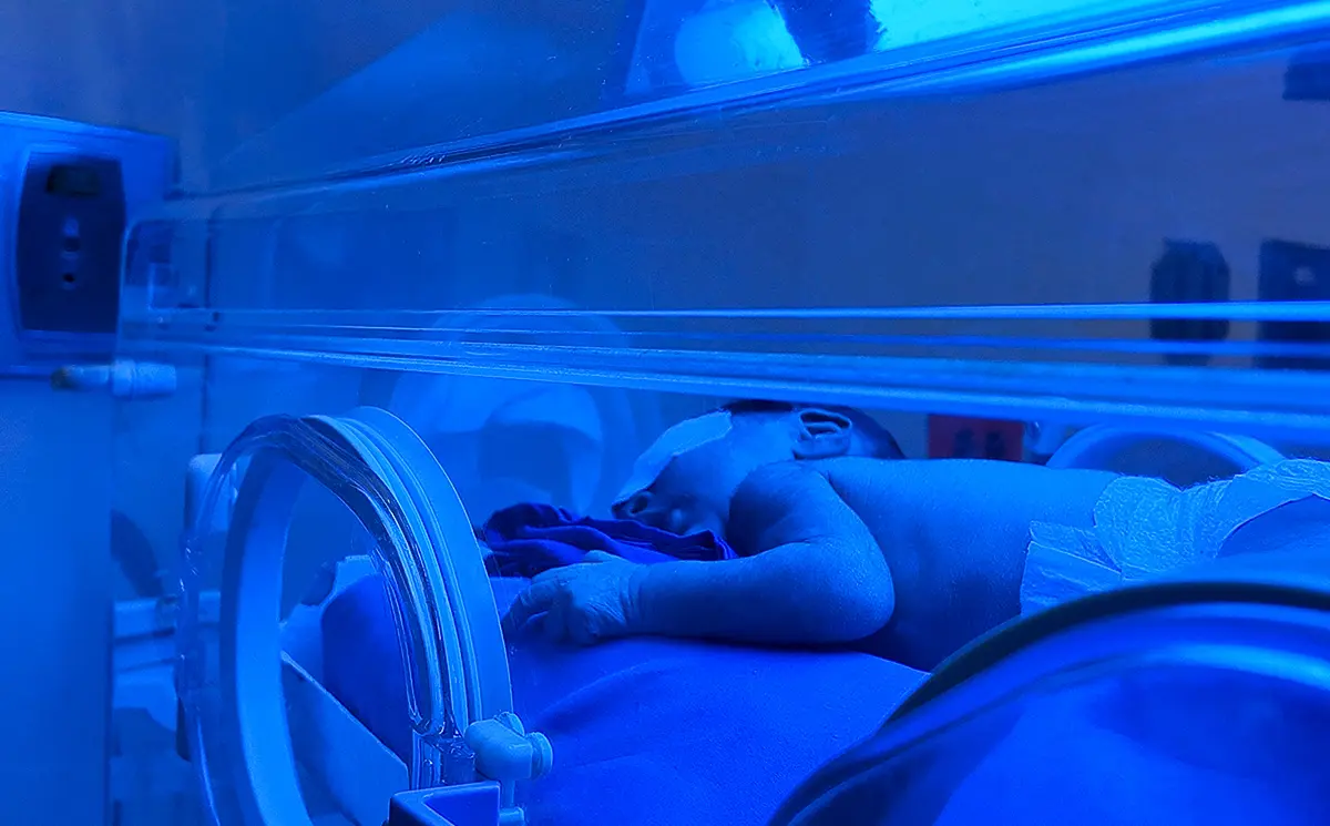 UCI Neonatal